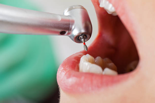 Best Weekend Emergency Dentist in Bradford, PA